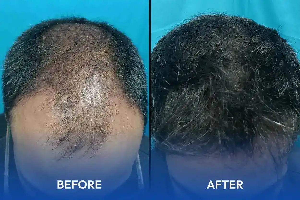 hair treatment specialist