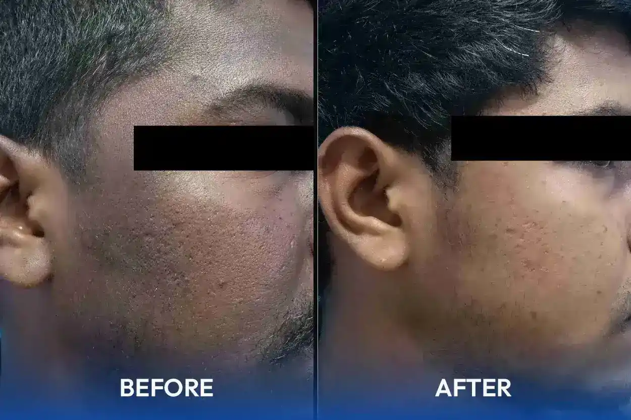 Hair and skin treatment