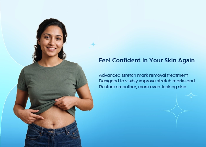 Stretch Marks