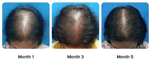 Shweta Narayanan