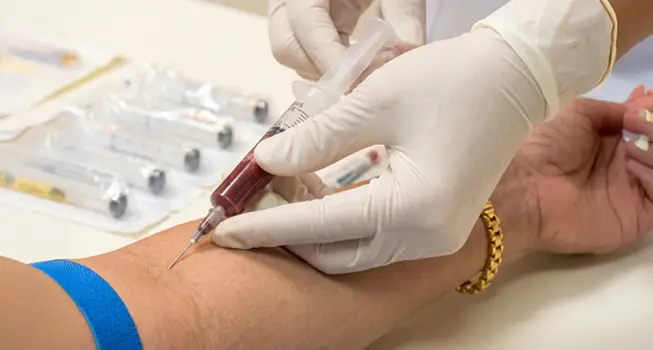 Blood Collection