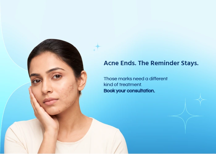 Acne Scars