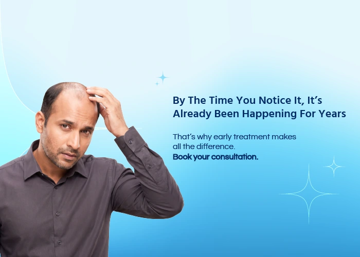 Baldness( Alopecia)