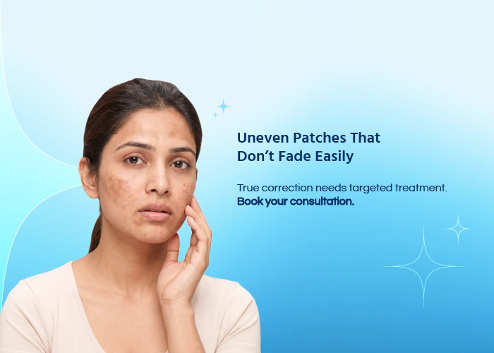 Skin Pigmentation