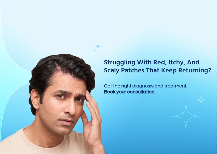 Psoriasis Treatment