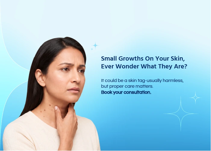 Skin Tag Removal
