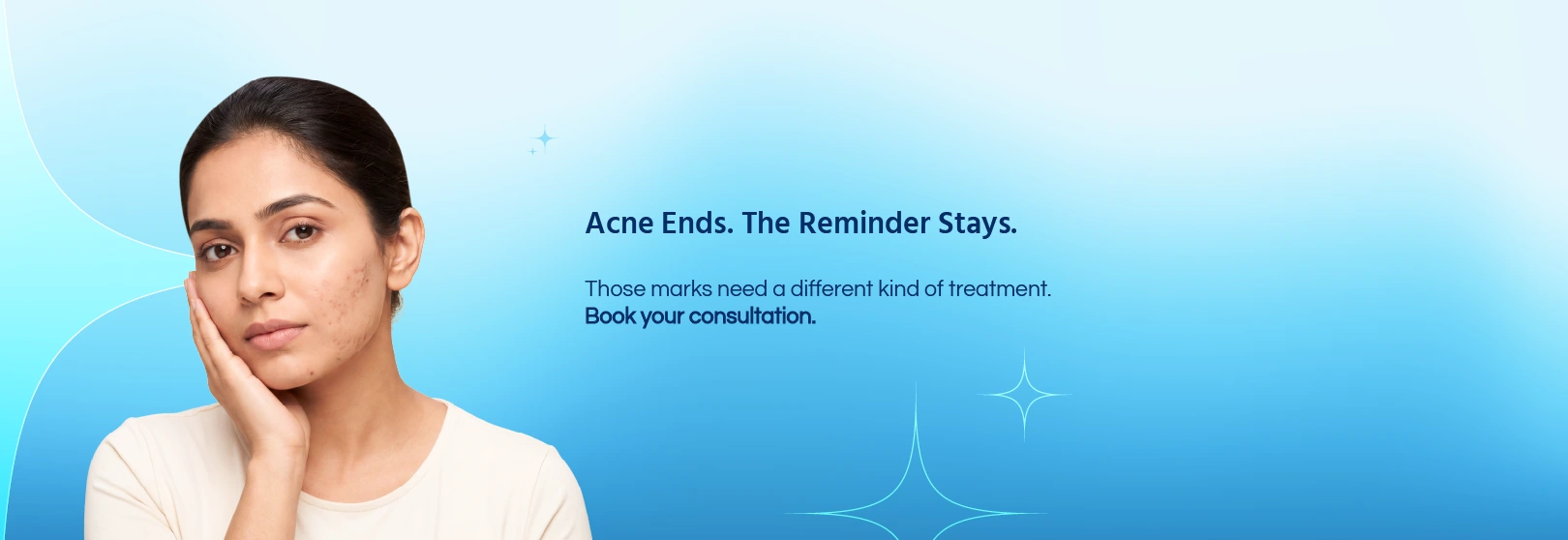 Acne Scars