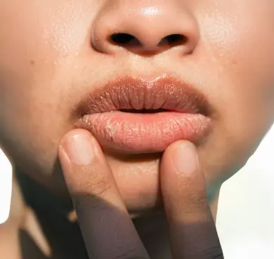 Dry, chapped, or flaky lips