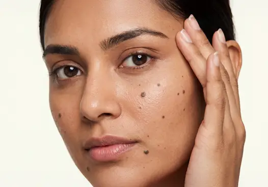 Flat Moles