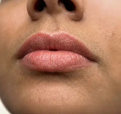 Frequent lipstick users experiencing lip damage