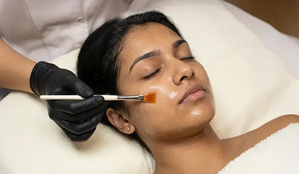 Glycolic Peel Application