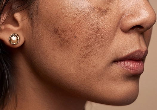 Individuals with dull, tired, or dehydrated skin