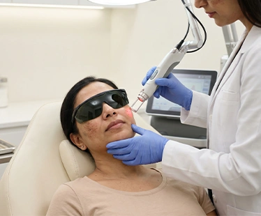 PICO Laser Treatment