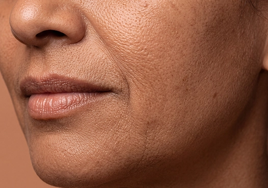 Those facing early signs of ageing like fine lines and loss of firmness