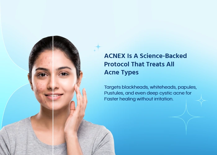 ACNEX Advanced Acne Treatment