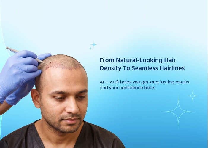 Activated Follicular Transplantation 2.0 (AFT 2.0)
