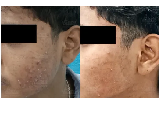 Before & After Anti-Aging Treatment Results