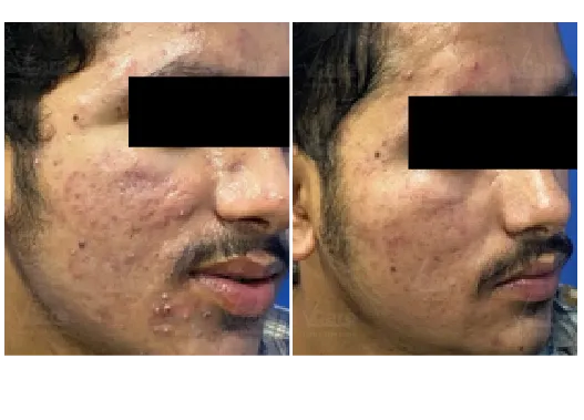 Before & After Anti-Aging Treatment Results