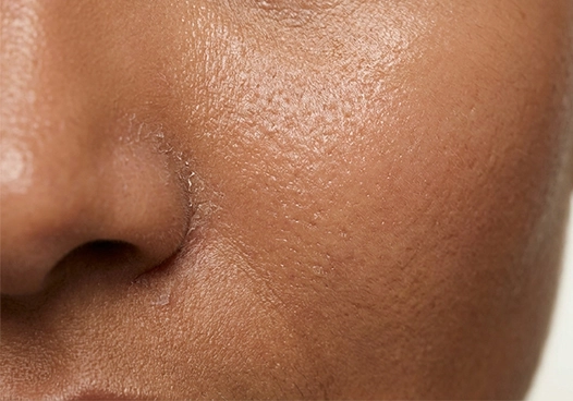 From hydration levels to skin elasticity