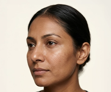Open Pores