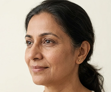 Drooping Nasal Tip