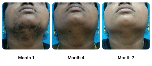 Deepa