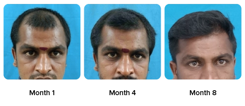 Manimaran