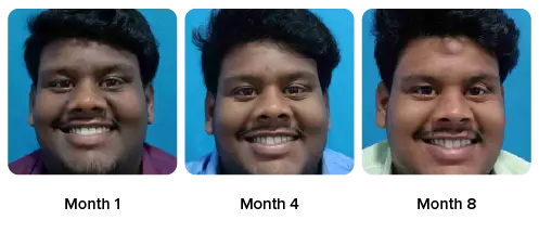 Sankar
