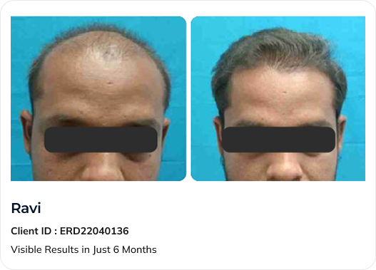 IV Skin Therapy Before and After
