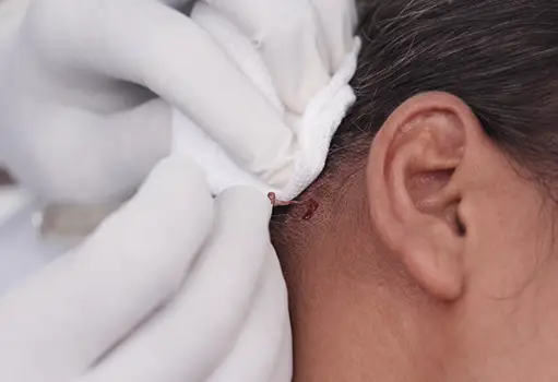 Cellgraft