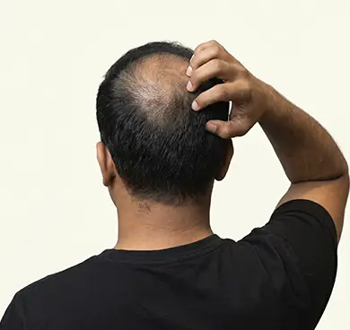 Men & women with hair thinning or reduced density