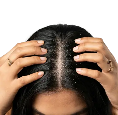 Anti-Dandruff treatment