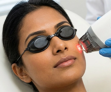 Q-Switch Laser Treatment