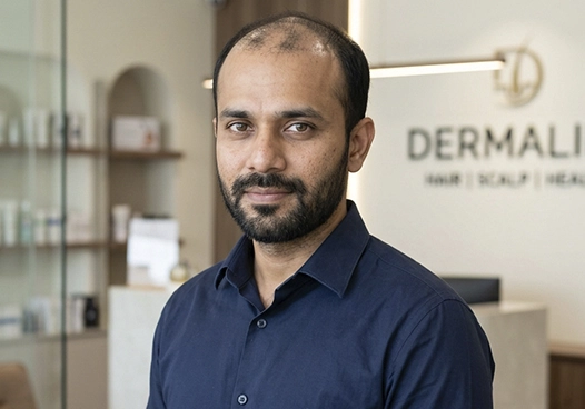 Patients with Grade 2 to Grade 5 hair loss