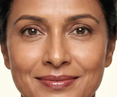 Individuals experiencing early ageing or collagen loss