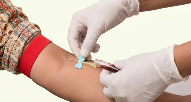 Blood Collection