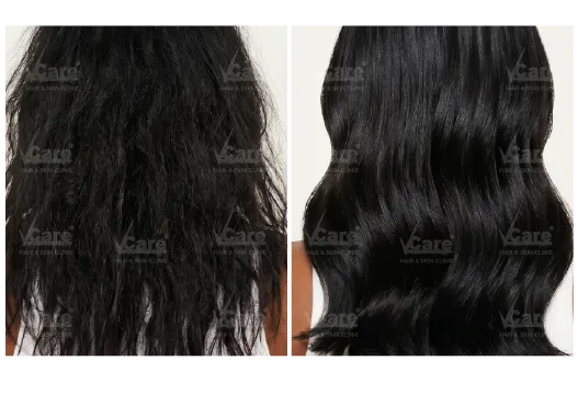 Before & After Hair Breakage & Split Ends Treatment Results