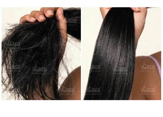 Before & After Hair Breakage & Split Ends Treatment Results