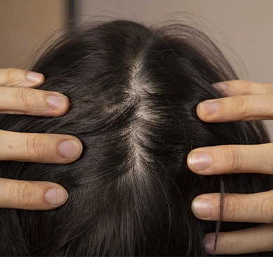 Those suffering from scalp dryness or excess oil