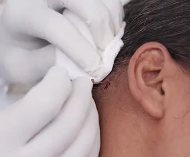 Cellgraft Hair Treatment