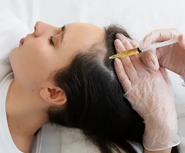 Exosome Hair Treatment