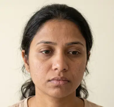 People with dull, dry, or dehydrated skin