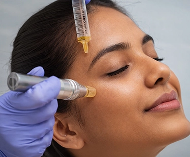 Acne Treatment