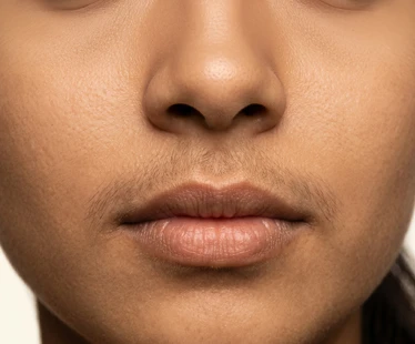Upper Lip