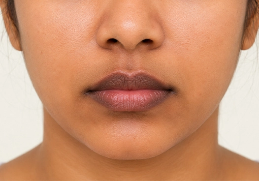 Individuals with dark or pigmented lips