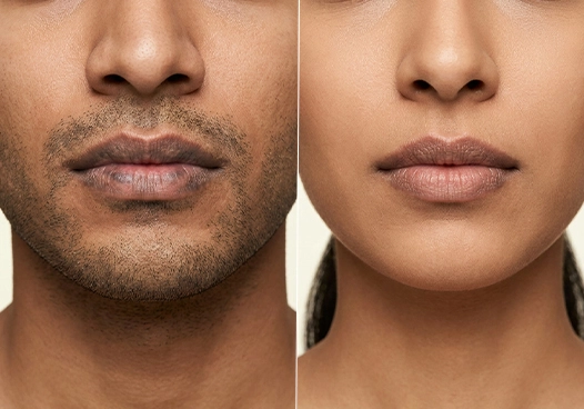 Men & women looking for non-invasive lip brightening solutions
