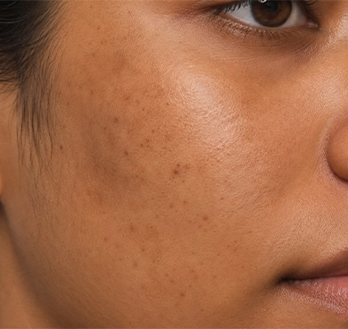 Anyone with sun-induced tanning or dull complexion