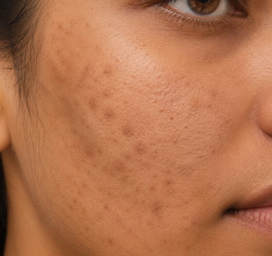 People with uneven texture, patchiness, and darkened areas
