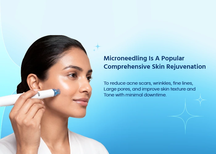 Microneedling Treatment
