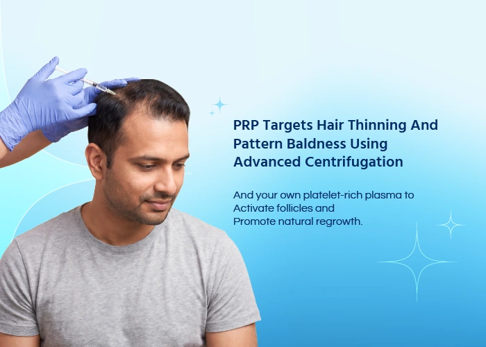 PRP Hair Treatment